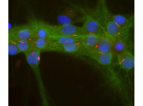 Immunofluorescence with Anti-Adenylate Cyclase III